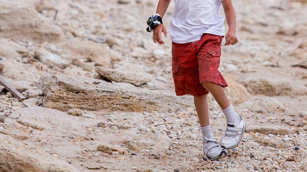 boy walking with bowlegged legs.