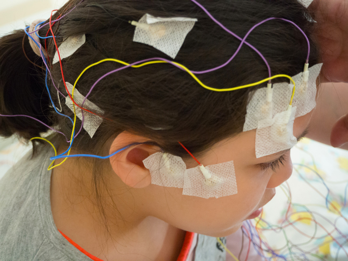 girl with electrodes on her head.