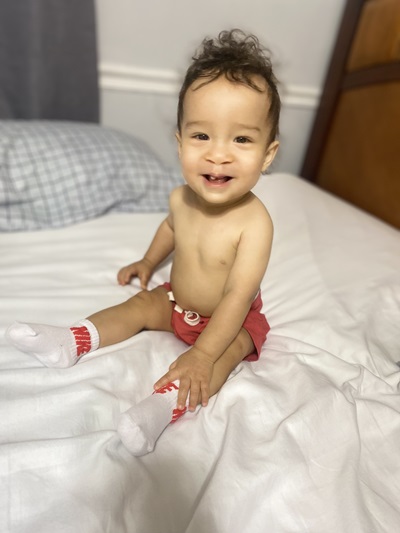 Jasiah smiling as a toddler post surgery